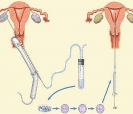 35岁女性备孕请做好以下检查，“健康泉州代生宝宝”跑不远